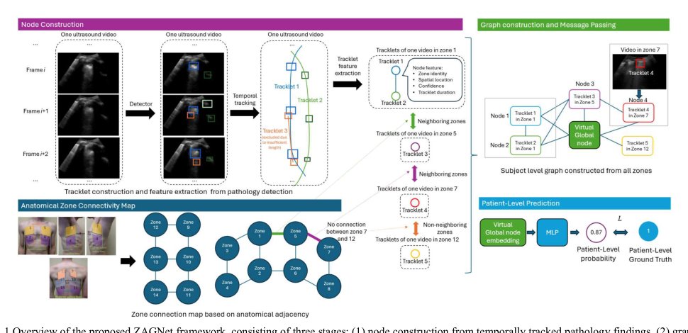 ZAGNet: Zone-Aware Graph Aggregation Network for Patient-Level Lung Ultrasound Diagnosis Figure 1