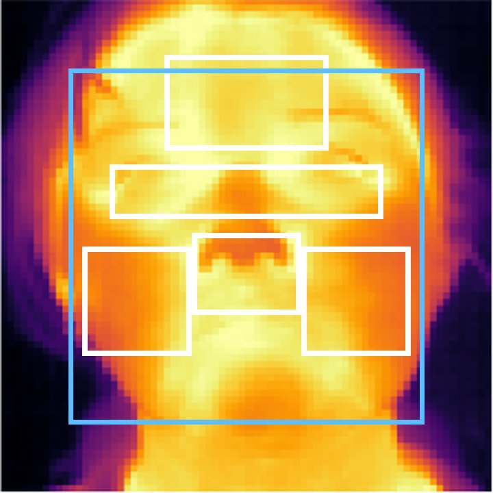 Oracle headroom without signal: null-calibrated evaluation of candidate selection for thermal heart rate estimation Figure 1