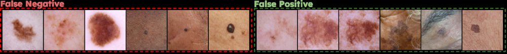 Bridging Research and Practice: A Systematic Evaluation of Generalist and Dermatology-Specific Models in Clinical Skin Lesion Classification Figure 1