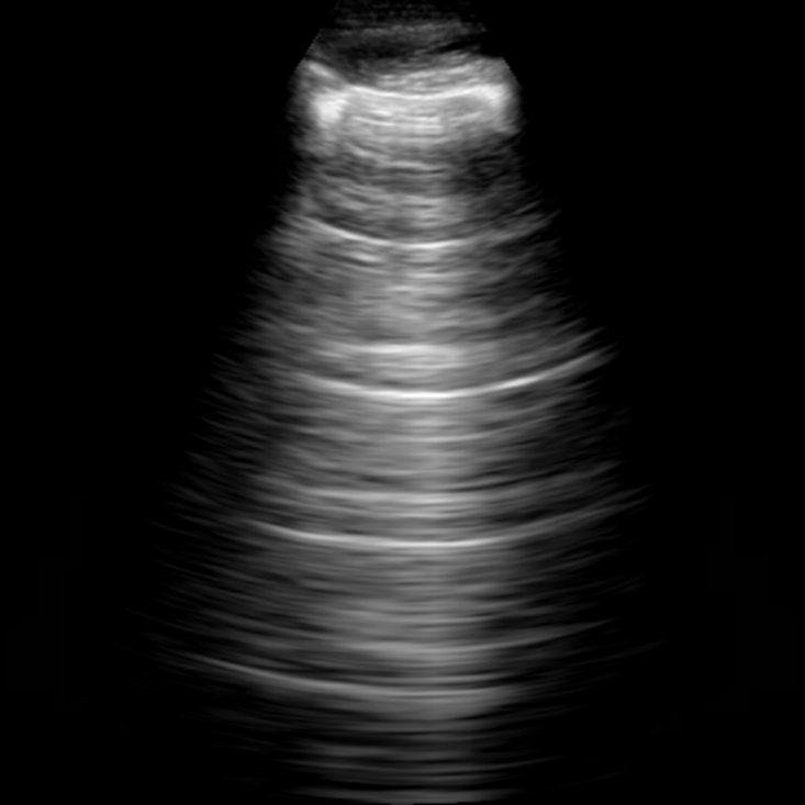 Wrong Organ, Right Physics: Transferring Echocardiography Pretraining to Lung Ultrasound for Tuberculosis Screening Figure 1