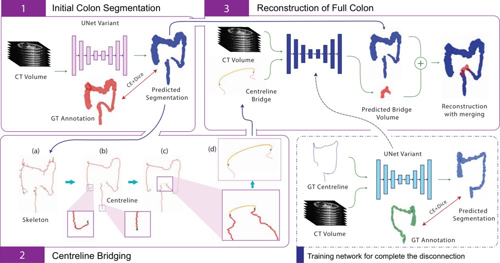 Preserving Anatomical Continuity: Three-Stage Pipeline for Colon Segmentation in 3D Abdominal CT Scans Figure 1