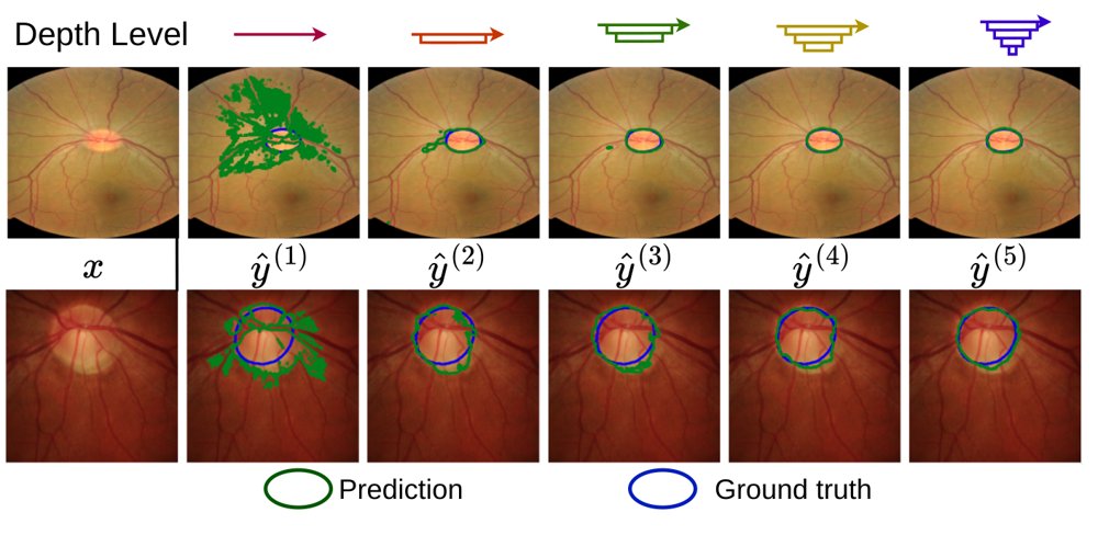 Fed-ADApt: Federated Anytime Depth Adaptation for Resource-Aware Medical Image Segmentation Figure 1