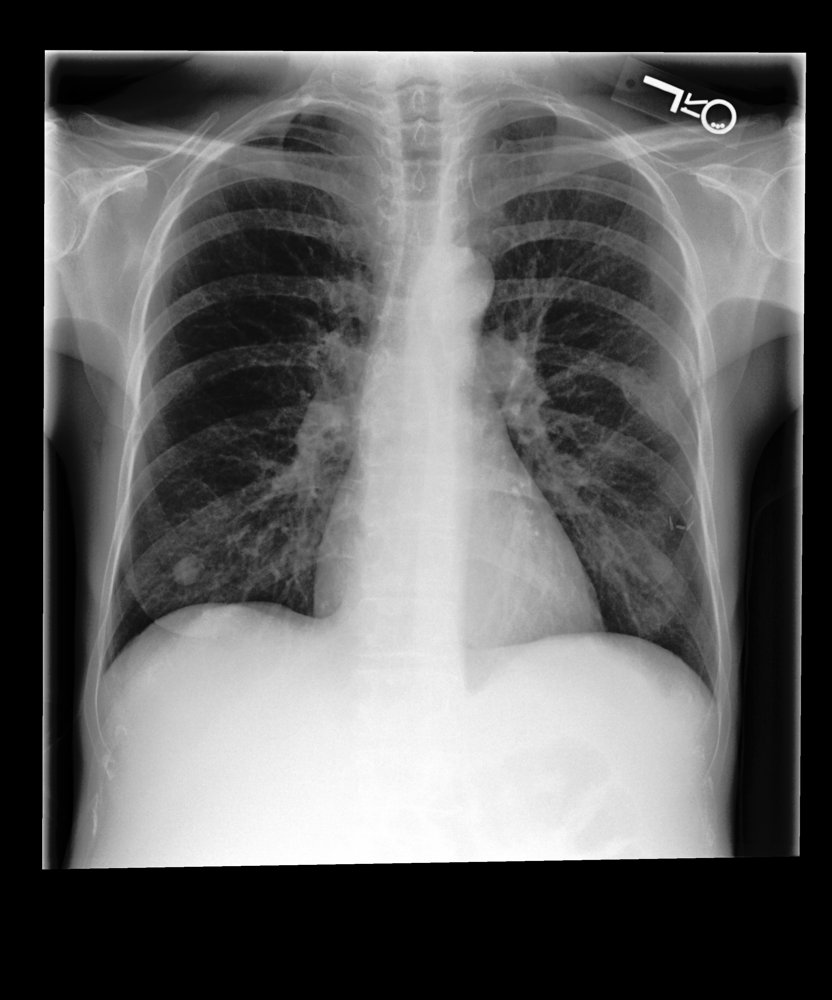 Diagnosis-Conditioned Spatial Gating and Decoder-Level Supervised Contrastive Learning for Radiology Report Generation Figure 1