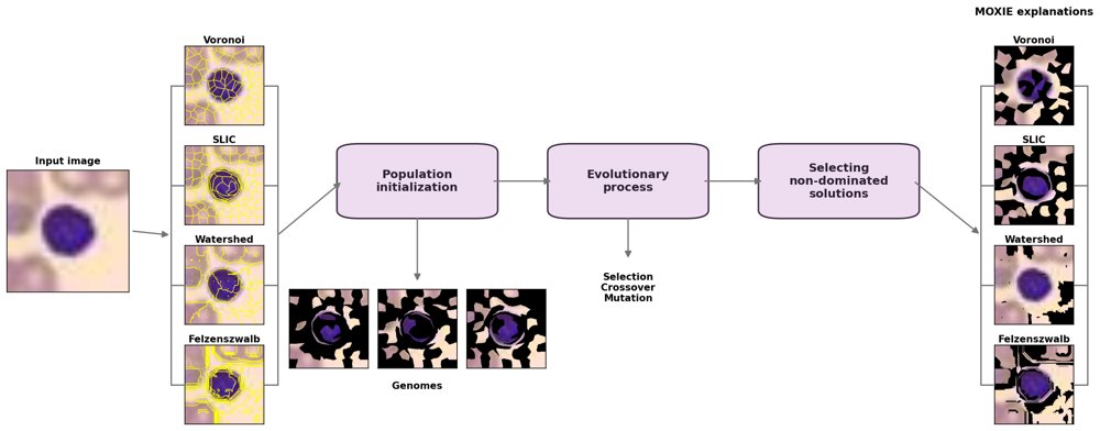 MOXIE: Discovering Alternative Explanations for Biomedical Image Classifiers Figure 1