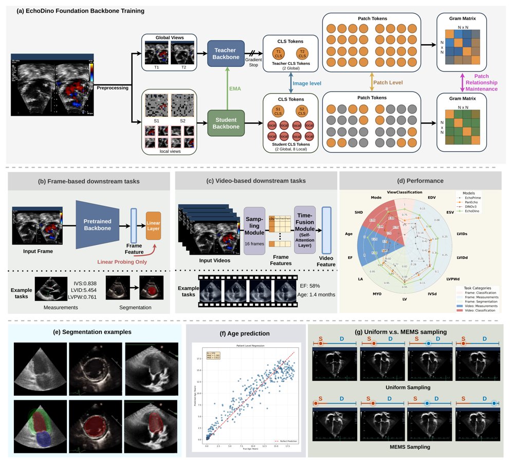 EchoDino: A pediatric foundation model for transferable echocardiographic analysis across the lifespan Figure 1