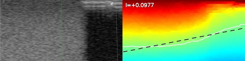 Dual-Rate Force-Image Control with Model-Based Orientation Limits for Robotic Ultrasound Figure 1
