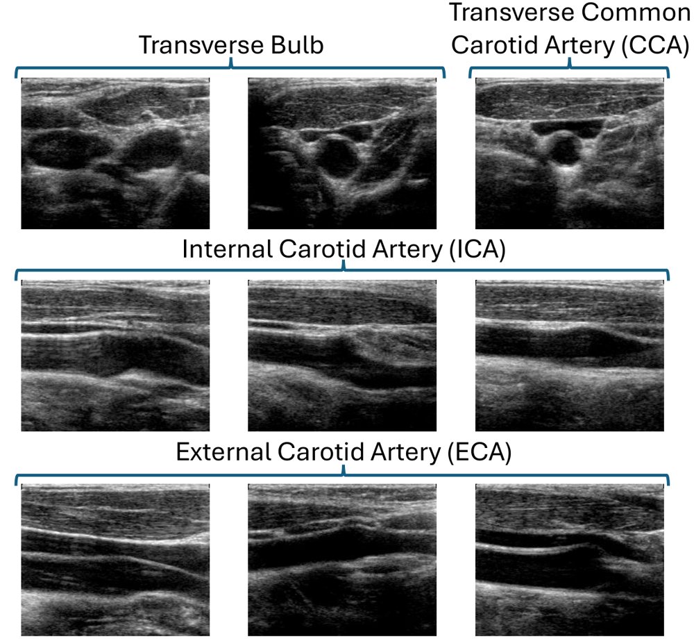 Ultrasound Operator Guidance Using World Modeling and Retrieval Based Action Planning Figure 1