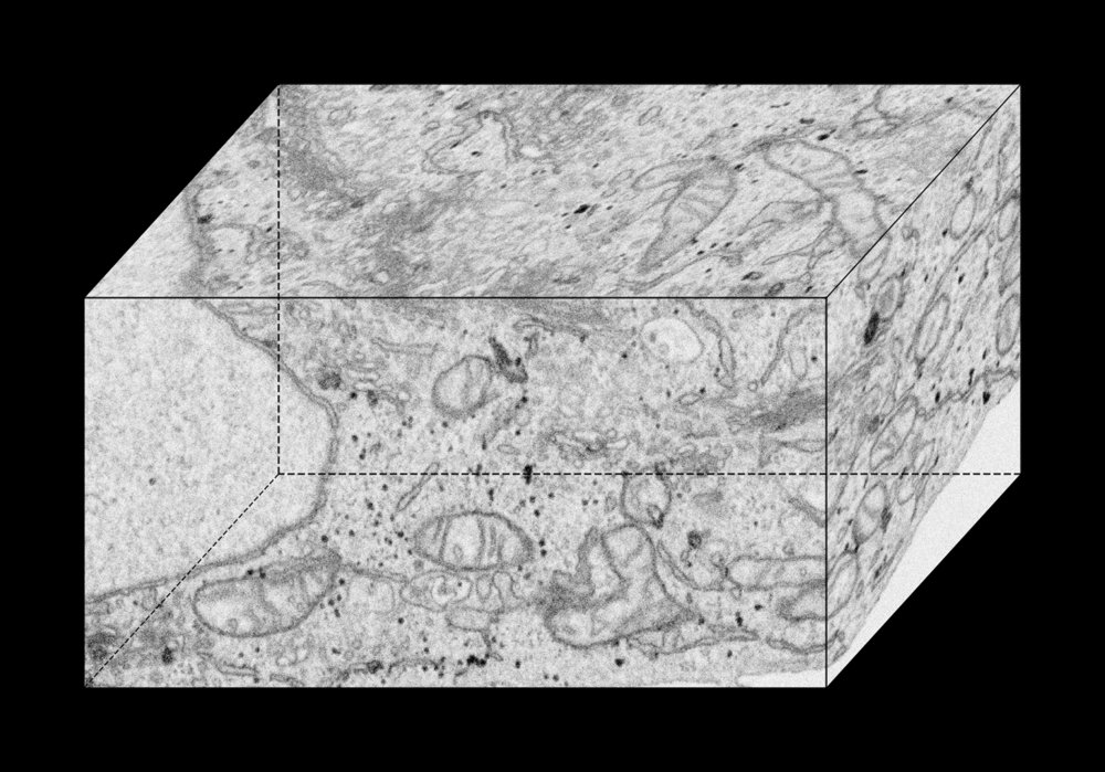 Patch-based Querying Identifies Structures of Interest in Electron Microscopy Figure 1