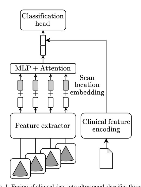 How well do routinely collected demographic and clinical variables aid point-of-care lung ultrasound TB classification Figure 1