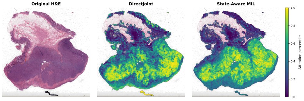State-Aware Interaction MIL for Rare Joint Molecular Phenotype Prediction in Colorectal Cancer and Lung Adenocarcinoma Figure 1