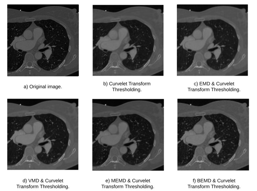 Decomposition-Guided Curvelet Thresholding for Sharp-to-Soft CT Kernel Conversion Figure 1