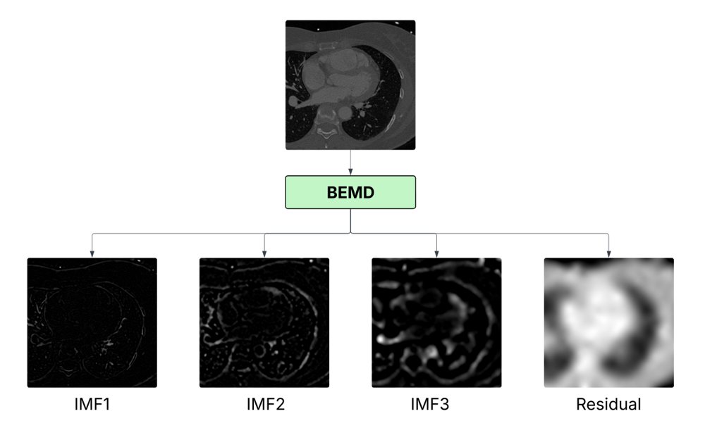 A BEMD-Based Quaternion Filtering Approach Sharp-to-Soft Kernel CT Image Conversion Figure 1
