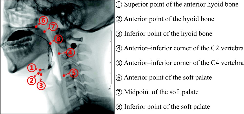 Structure-aware Keypoint Localization for Videofluoroscopic Swallowing Study Figure 1