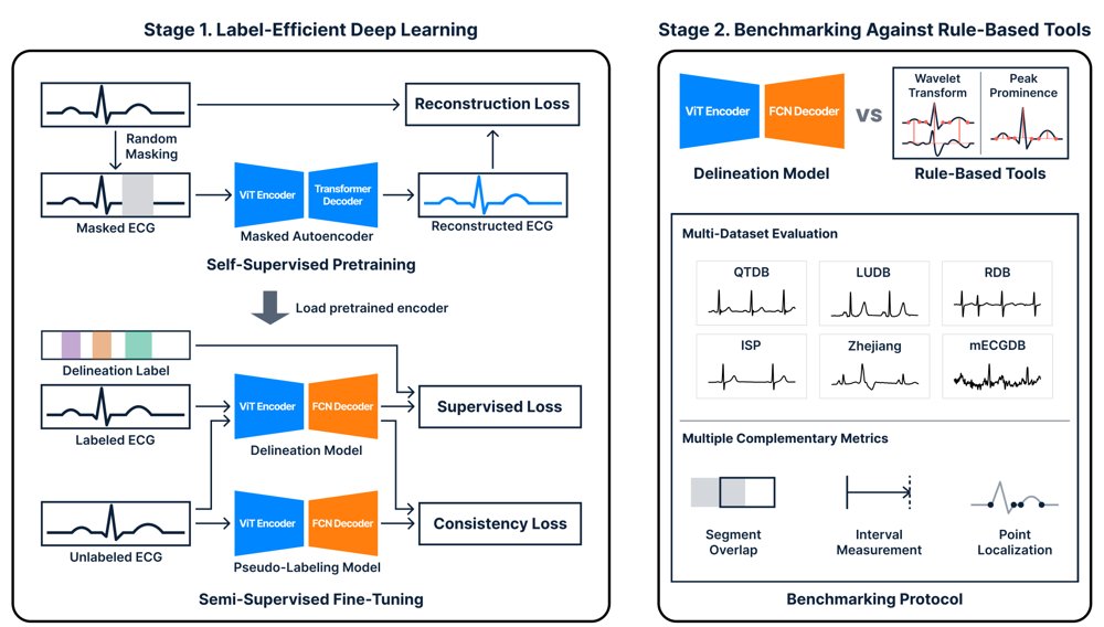 Label-Efficient Deep Learning for ECG Delineation: A Multi-Dataset Benchmark against Widely Used Delineation Tools Figure 1