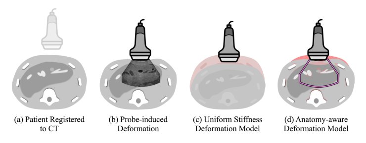Deformable CT-US Registration via Anatomy-Aware Implicit Neural Representations Figure 1