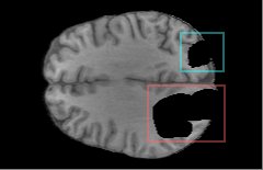 Zero-Shot Brain MRI Inpainting with 2.5D Unconditional Flow Priors Figure 1