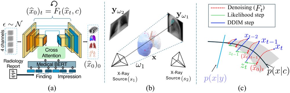 PhyDiCT: Plug-and-Play CT Reconstruction from Sparse X-Rays via Differentiable Rendering and Strong Priors Figure 1