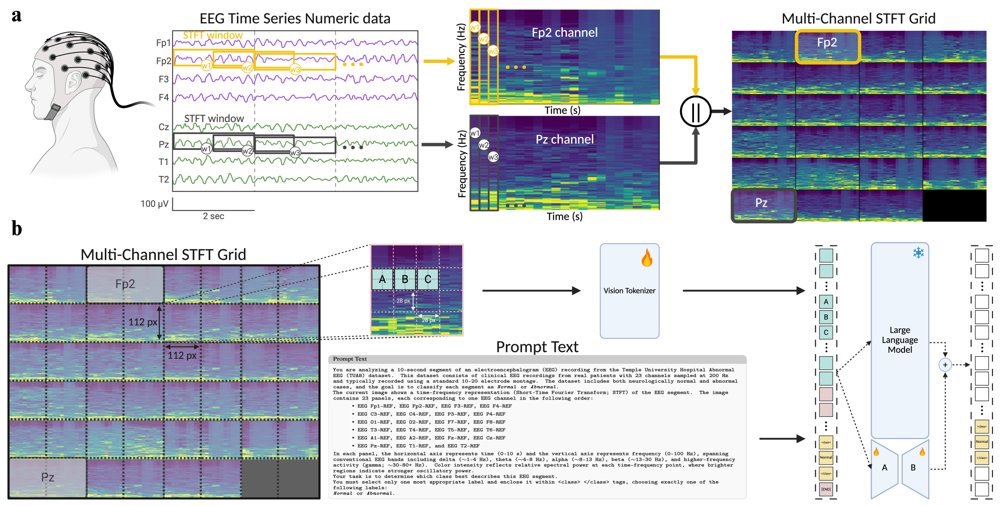 Multimodal LLMs Can Learn to Read Brain Signals: A Vision--Language Model for Unified Multi-Task EEG Decoding Figure 1