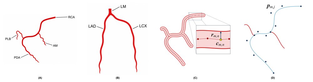 PPCAR-Net: Projection-Refined Parametric 3D Coronary Artery Reconstruction from Sparse X-ray Angiographic Views Figure 1