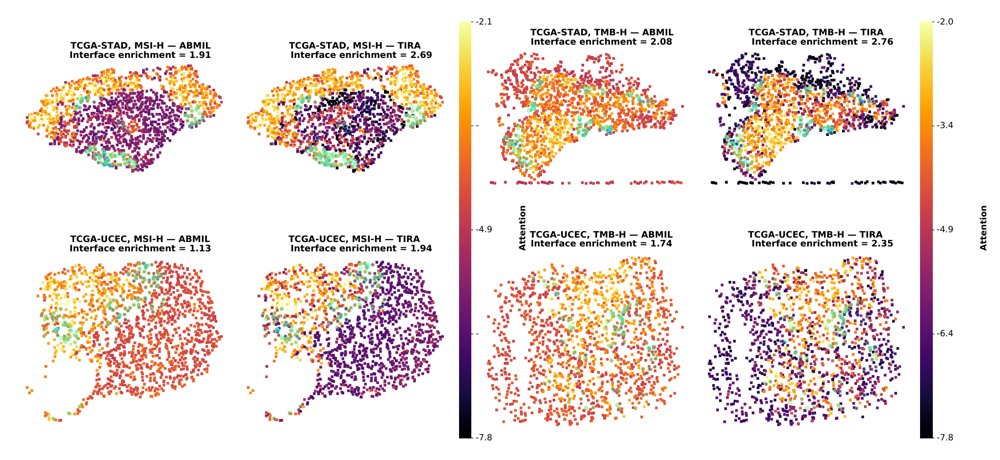 TIRA: Tumor Immune Representation Adaptation for Zero-Shot Cross-Cancer MSI and TMB Prediction Figure 1