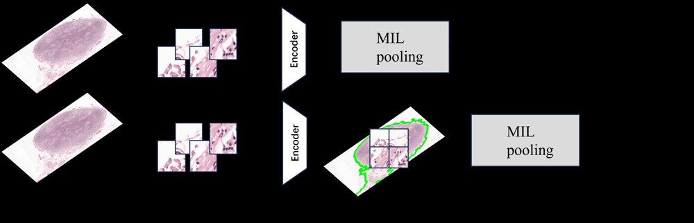 Masked Feature Encoding for Large-Scale Whole Slide Image Representation Figure 1