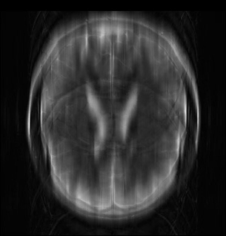 Hankel Subspace Self-Supervised Learning for Parallel MRI Reconstruction Figure 1