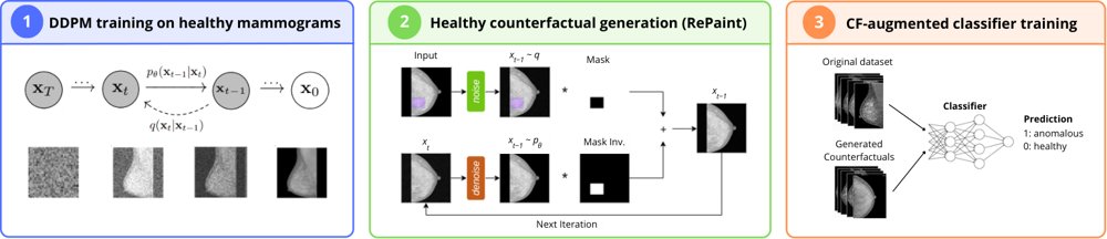 Healthy Counterfactual Generation via Diffusion Inpainting for Mammography Classification Figure 1
