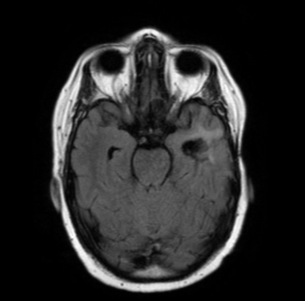 A4-MR: Abnormality-aware Anatomical Alignment for MR Figure 1