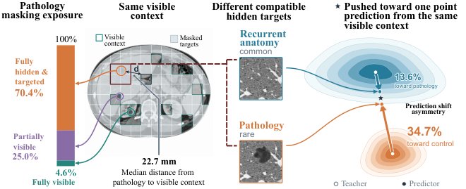 The Predictability Bias of Joint-Embedding Predictive Learning in Medical Imaging Figure 1