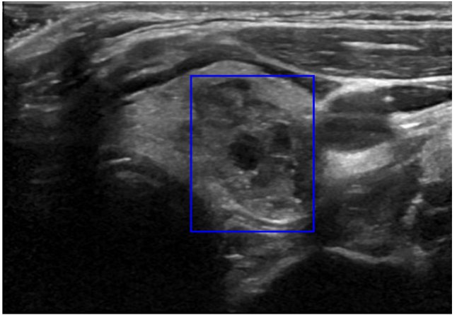 Radiomics-Based Thyroid Nodule Classification with Label-Conditional Conformal Prediction Figure 1