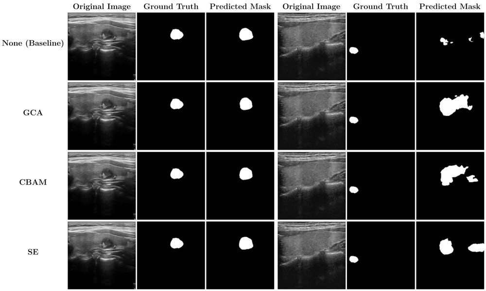 Thyroid Nodule Segmentation in Ultrasound Images with Conformal Uncertainty Estimation Figure 1