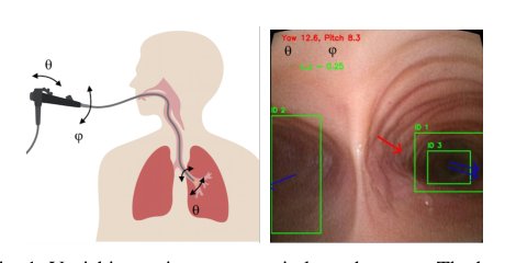 Geometry-Aware Visual Odometry for Bronchoscopic Navigation via High-Gain Observer Fusion Figure 1