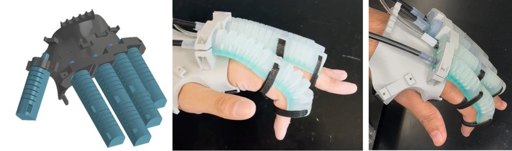 Soft Robotic Exogloves for Dexterous Mobility -- Towards Personalized Rehabilitation Figure 1
