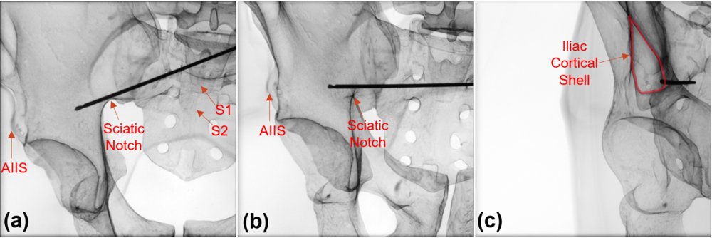 X-GuideAR: An Augmented Reality Framework to Mitigate Radiation Exposure during Fluoroscopic Guidance Figure 1