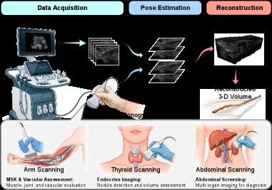 Seeing Globally, Refining Locally: Global Visual Guidance and Local Ultrasound Cues for Robust Freehand 3-D Ultrasound Reconstruction Figure 1