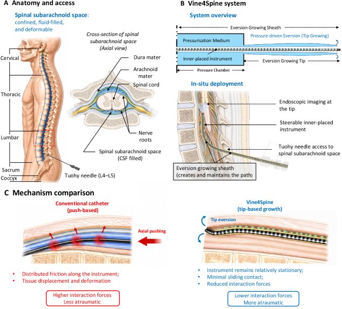 Eversion-based robots can enable safe access,steering and endoscopic imaging within the spinal subarachnoid space Figure 1
