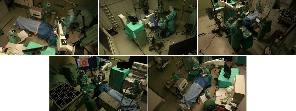 Surgical Re-enactment for Operating Room Workflow Datasets Figure 1