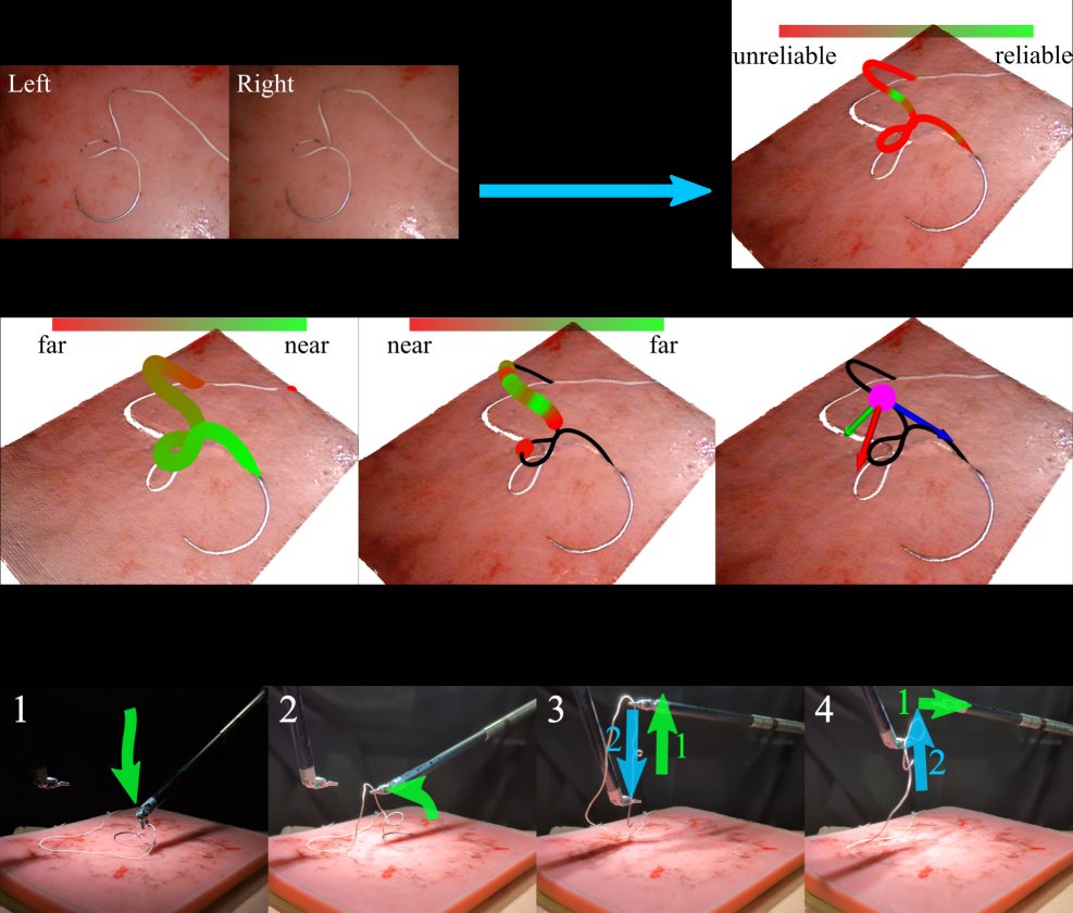 Reeling It In: Flexible Needle Pick Up via Thread Manipulation for Autonomous Suturing Figure 1