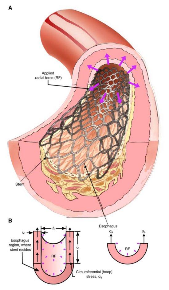 RoSE: A Robotic Soft Esophagus for Endoprosthetic Stent Testing Figure 1