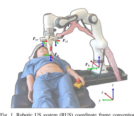 From Self-Normal-Positioning to Omni-Directional Tracking: Real-Time Surface Modeling Enabled Probe Tilt Control for Robotic Ultrasound Imaging Figure 1