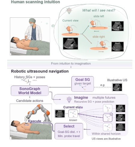 Scanning While Imagining: A Scene-Graph World Model for Robotic Ultrasound Navigation Figure 1