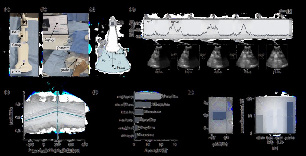 Contact-Adaptive Robotic Ultrasound Probe Control for Tissue Exploration and Continuous Task-Relevant Visualization Using Robot-Free Image-Motion Demonstration Figure 1