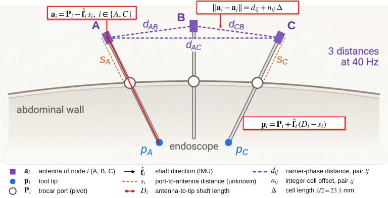 Drape-Compatible Tool-Tip Localization for Hand-Held Laparoscopic Instruments via UWB Carrier-Phase Ranging and Trocar-Constrained Geometry Figure 1
