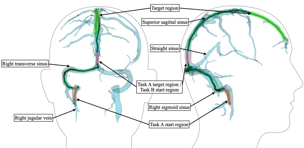 Autonomous Robotic Navigation for Endovascular Brain-Computer Interface Access Figure 1