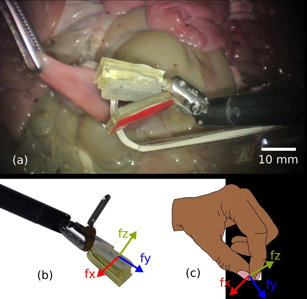 Hall Effect-Based Tactile Force Detection Sensor for Robot-Assisted Minimally Invasive Surgery Figure 1
