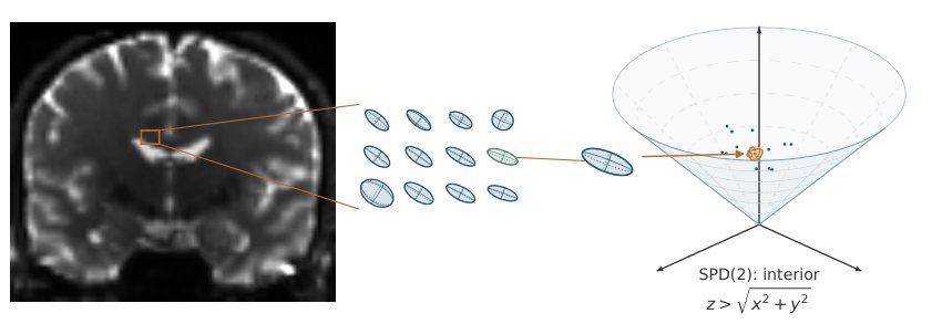 Locally Private Inference for Riemannian Stochastic Optimization Figure 1