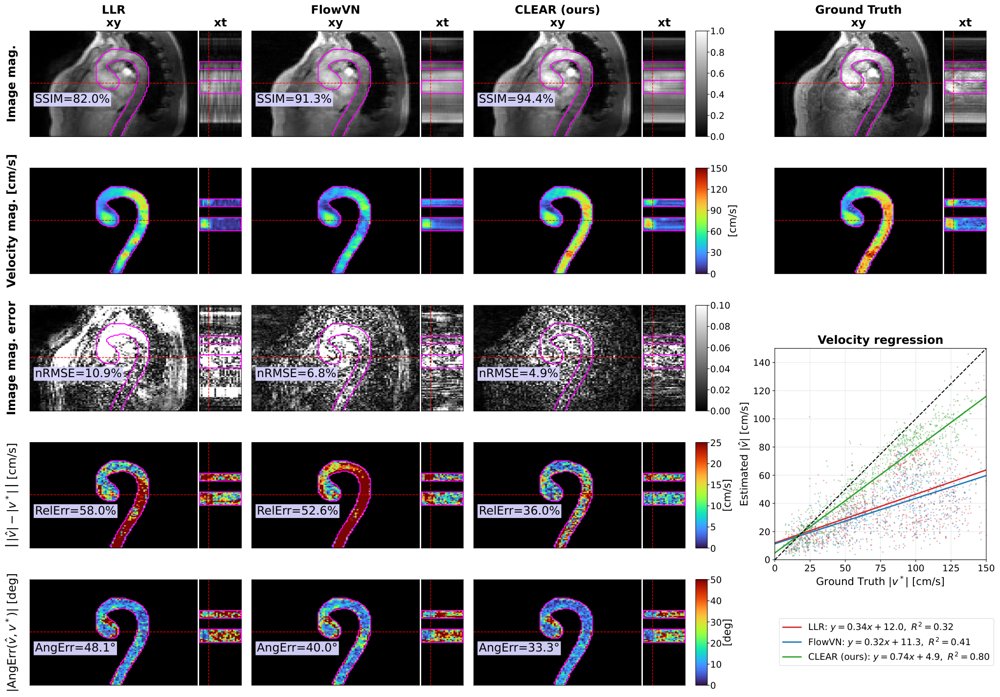 CLEAR: Complex Learned Explicit Analytical Regularization for Ultra-Accelerated 4D Flow CMR Reconstruction Figure 1