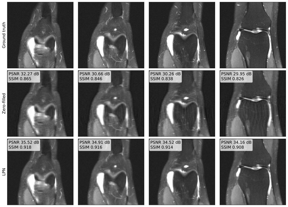 Plug-and-Play Methods Provably Converge Even with Improperly Trained Denoisers: Convergence by Architectural Design Figure 1