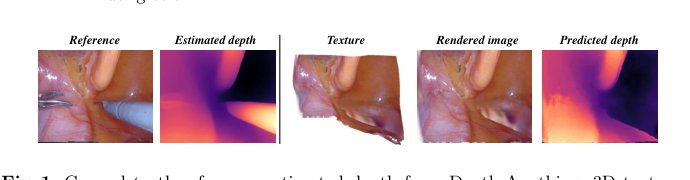 Endo-4DGS: Endoscopic Monocular Scene Reconstruction with 4D Gaussian Splatting Figure 1
