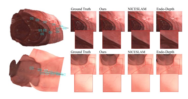 EndoGSLAM: Real-Time Dense Reconstruction and Tracking in Endoscopic Surgeries using Gaussian Splatting Figure 1